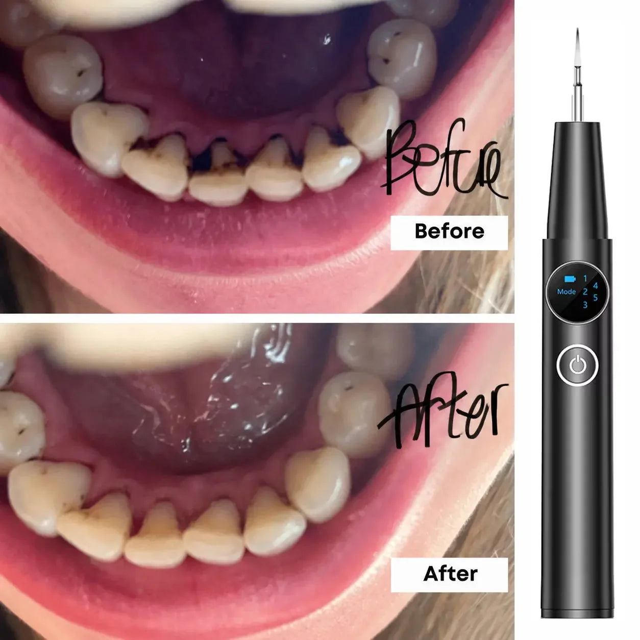 TartarOff Pro before and after - Black