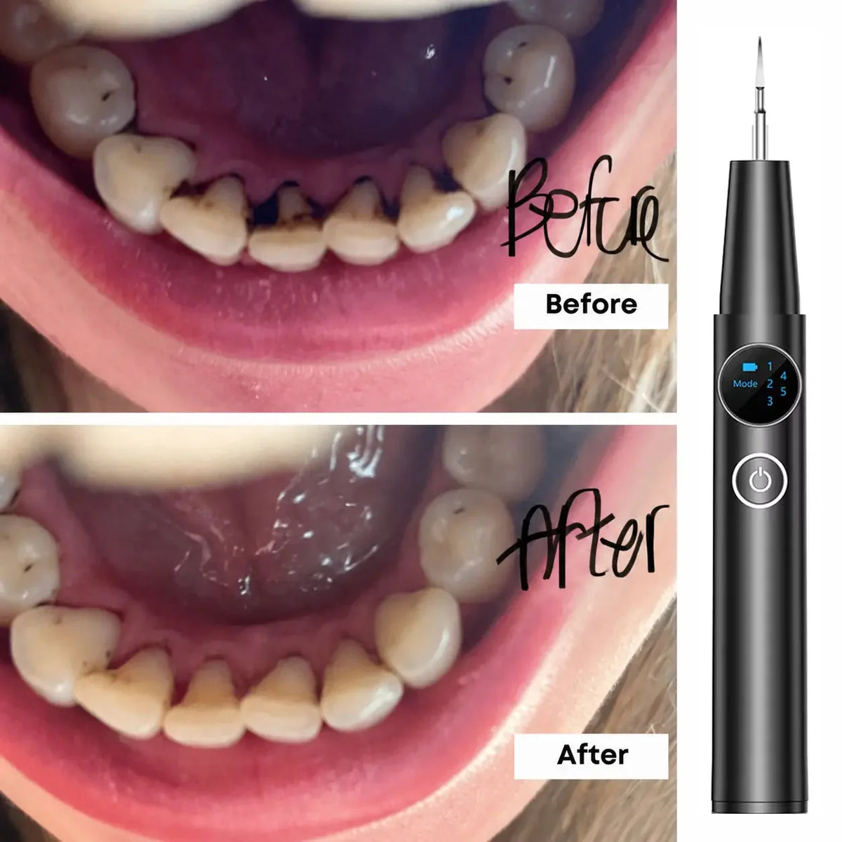 TartarOff Pro before and after - Black