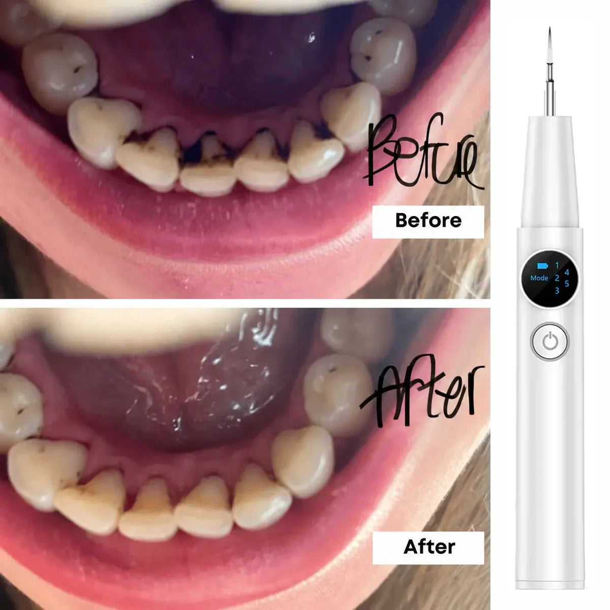 TartarOff Pro before and after - White
